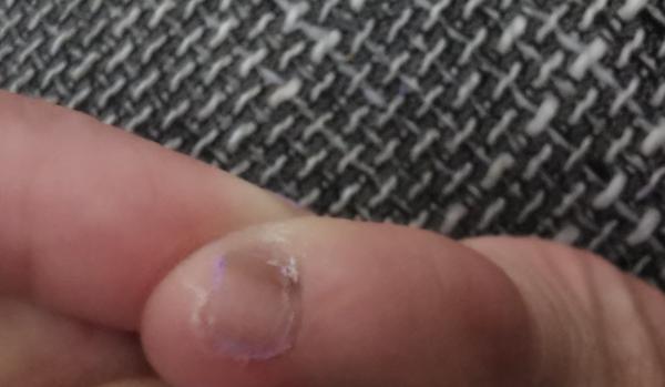 Čierne fľaky na nechte