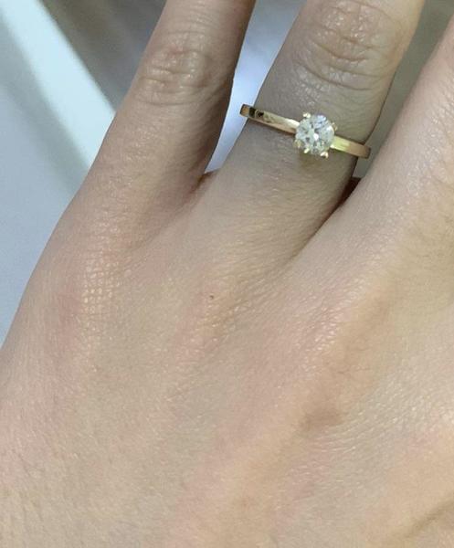 Sfarbená pokožka pod zlatým prsteňom