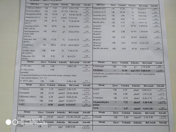Je v poriadku, keď dvojročné dieťa má zvýšený D-dimér?