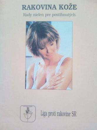 Rakovina kože, 