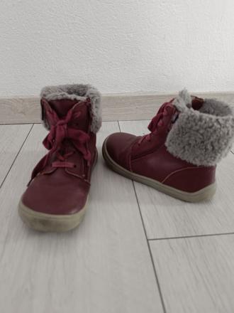 Zimne barefoot topánočky, protetika,27