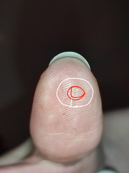 Ako zistiť, či sú vši skutočne preč?