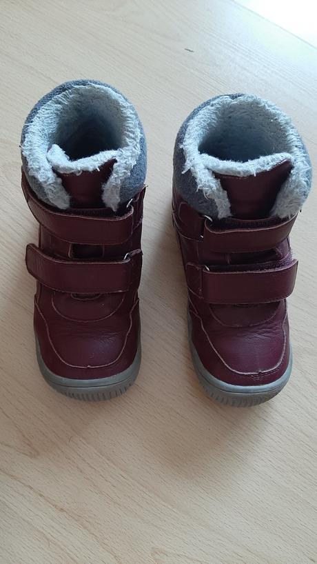 Zimne protetika barefoot, protetika,32