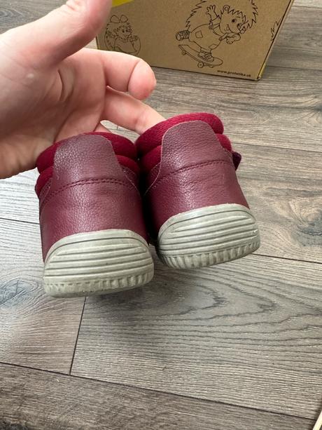 Protetika prechodné topánky, protetika,33