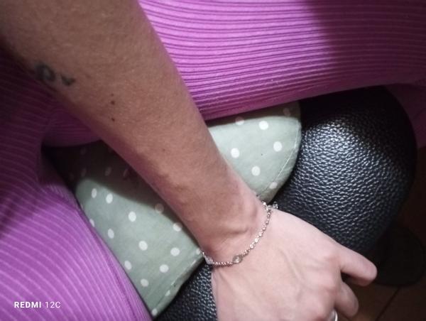 Čo spôsobuje hrčky na žile?