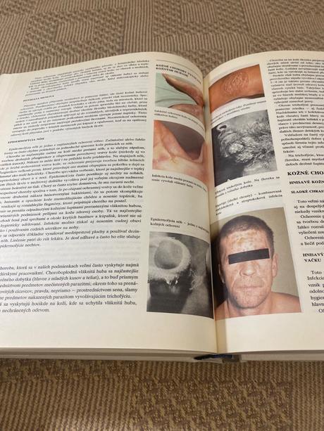 Obrovská stará retro kniha zdravoveda osveta 1980, 