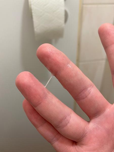 Je to plodný hlien?