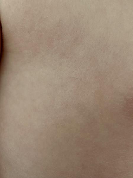 Tmavý chlp u trojročného dieťaťa