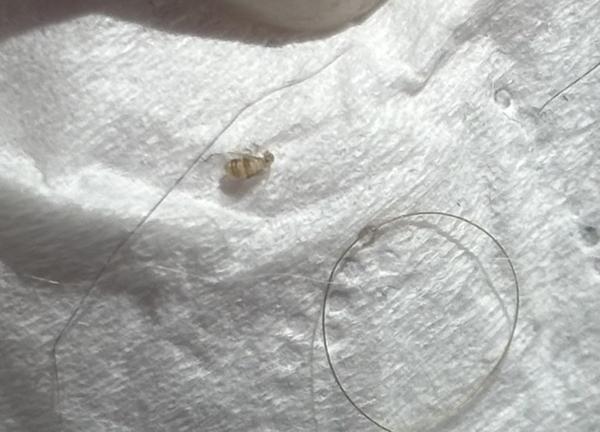 Môže to byť naozaj blcha?