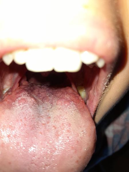 Hrbolčeky - chuťové poháriky