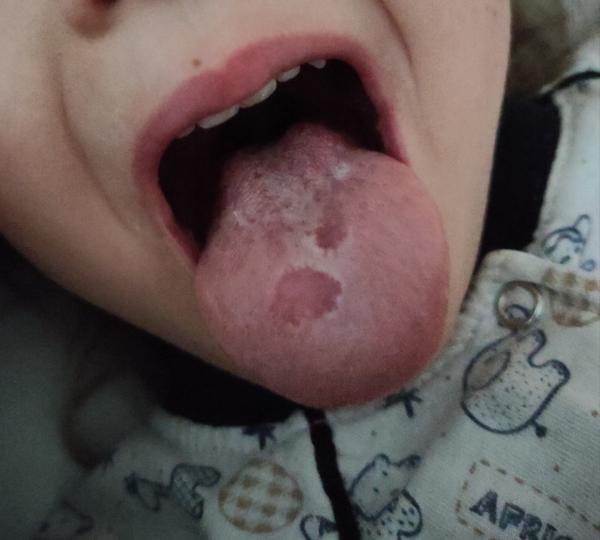 Čo to má dcérka na jazyku?