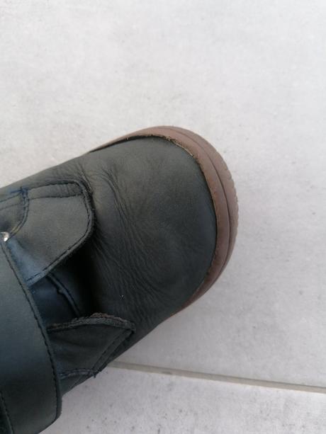 Prechodné protetika, protetika,35