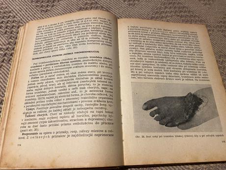 Vnútorné lekárstvo 2 k. bobek, j. havránek 1966,