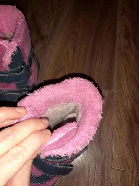 Čižmy sú, protetika,32