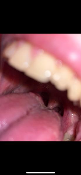 Čo to môže byť na jazyku?