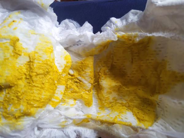 Štvormesačný syn má po zavedení mrkvy žltú stolicu. Čo mi odporúčate?