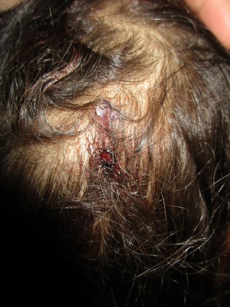 Rozbitá hlava a vlasy v zalepenej rane