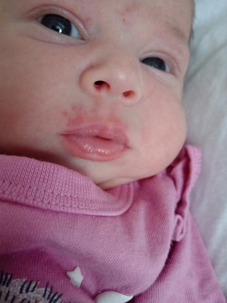 Prečo sa objavil červený fľak nad perou?