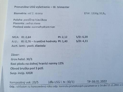 Zlepšili sa prietoky a bude plod prosperovať?