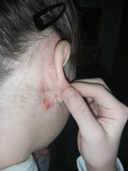 Kožné problémy u detí