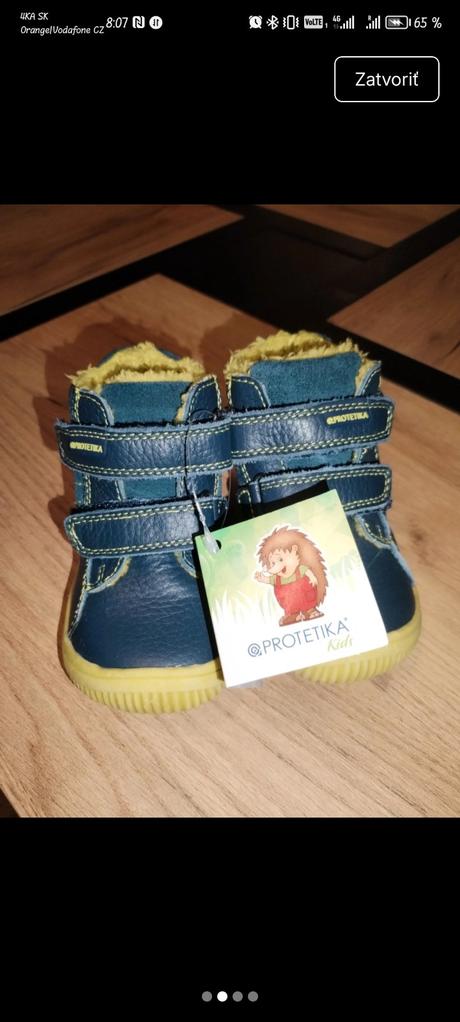 Nové kožené topánky protetika zateplené, protetika,20