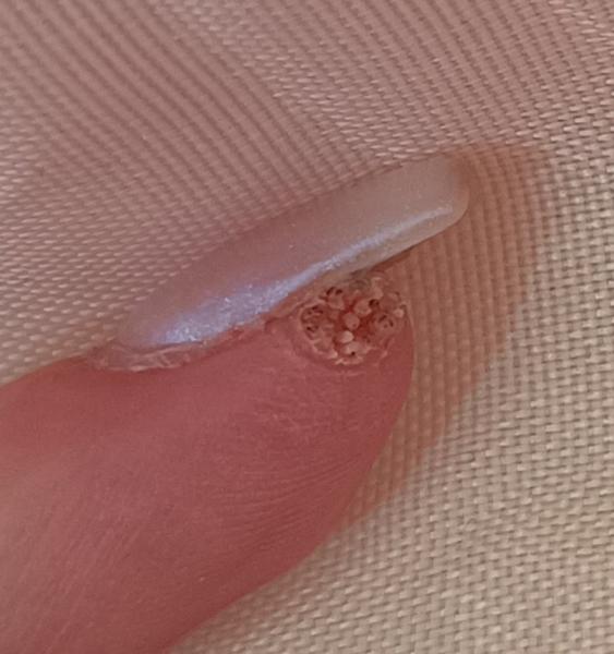 Prečo sa objavuje bolesť a krvácanie?