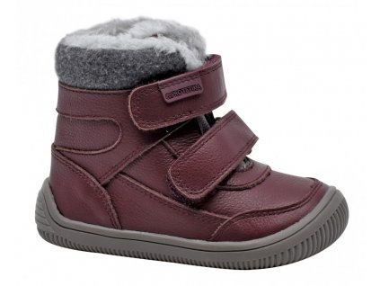 D zimne barefoot protetika tamira bordo, protetika,19 / 31