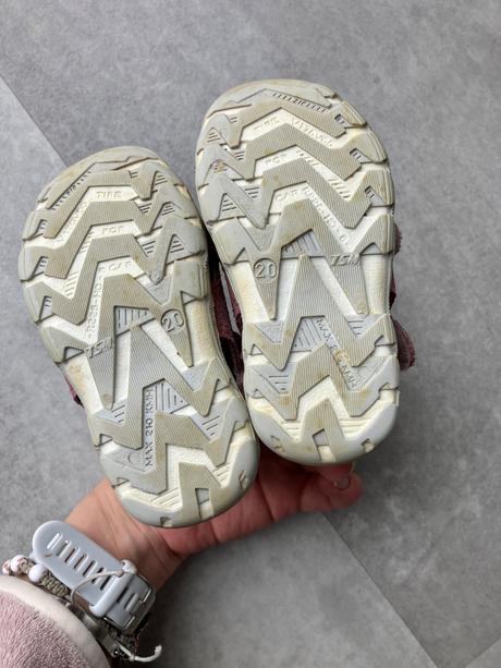 Sandálky protetika, protetika,20