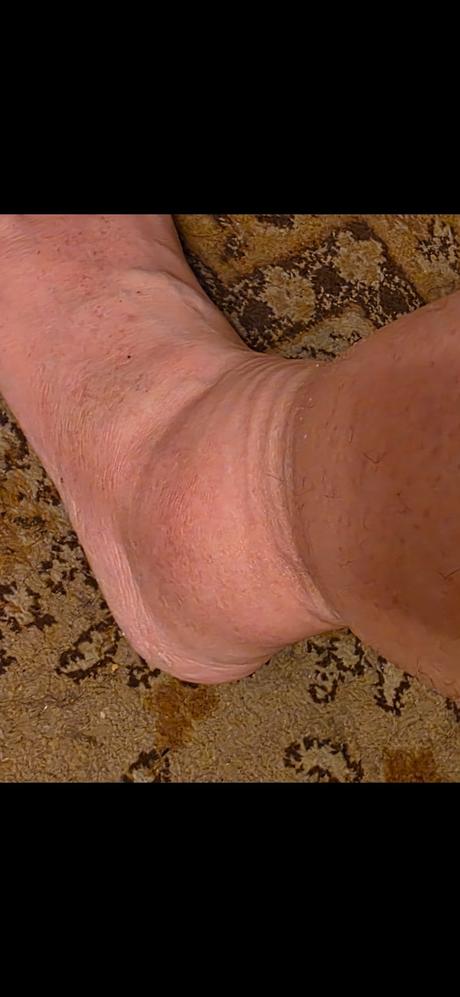 Botasky gesoft 41 s pameťovou penou, 41