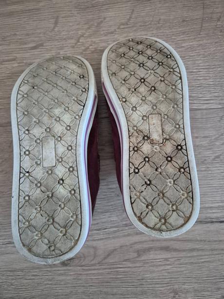 Tenisky, protetika,33