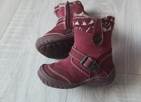 Čižmičky, protetika,20