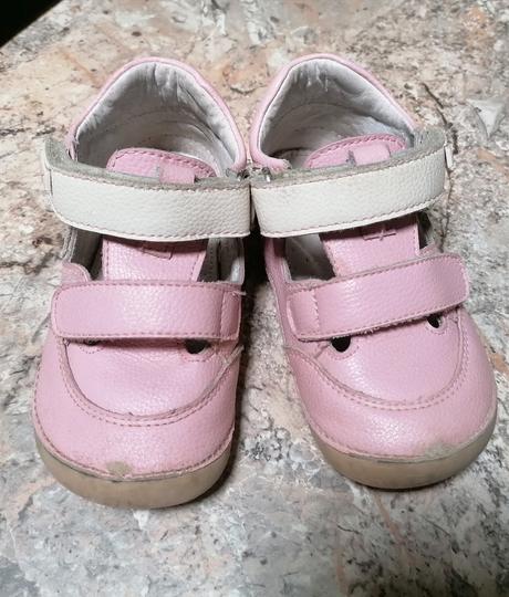 Protetika sandalky, protetika,23