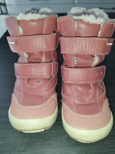 Zimne topánky, protetika,26