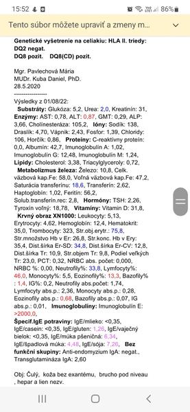 Ako máme 8-ročnému synovi upraviť celkovú stravu?