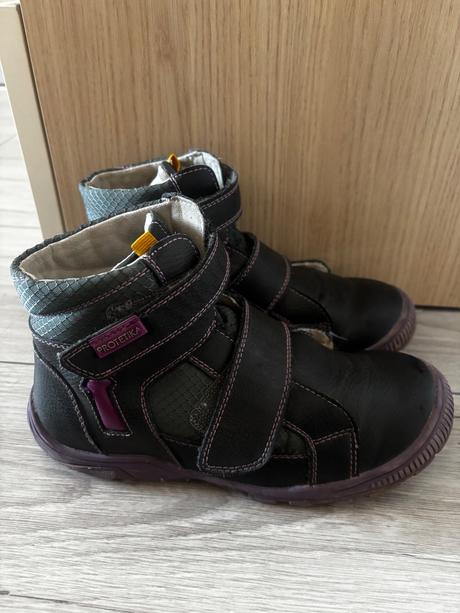 Prechodné topánky od protetiky, protetika,32