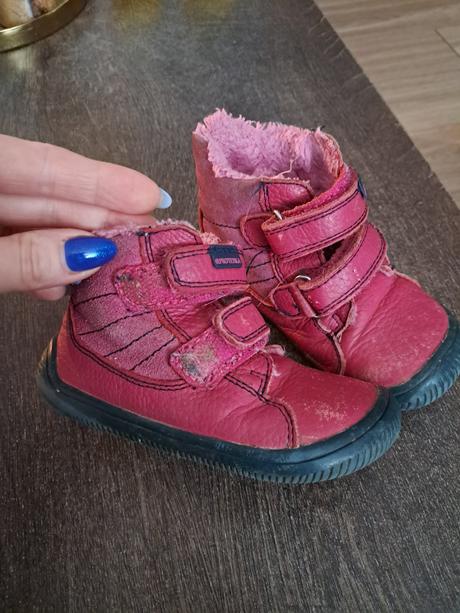 Prechodne topanky, protetika,22