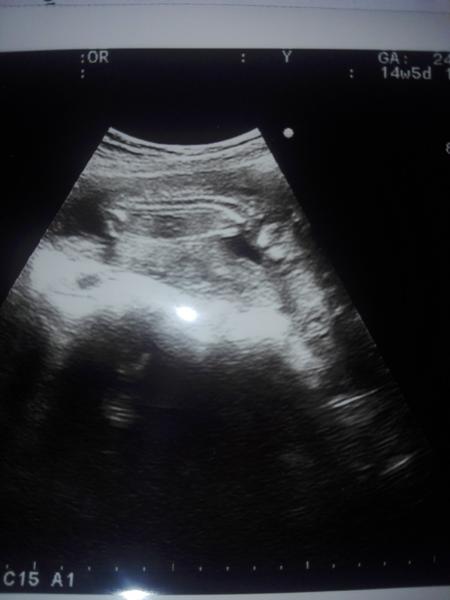 Bude to dievka alebo chlapček?