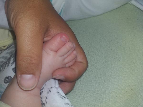 Necht u trojmesačného bábätka