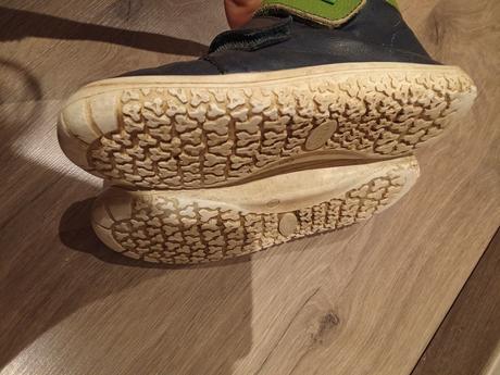 Kožené prechodné topánky protetika alternatíva, protetika,31