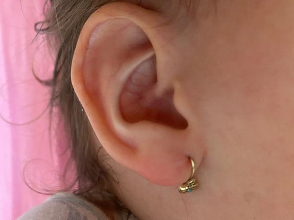 Čo to má dcérka za čiarku na laloku uška?