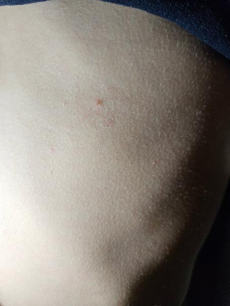 Sú to ovčie kiahne?