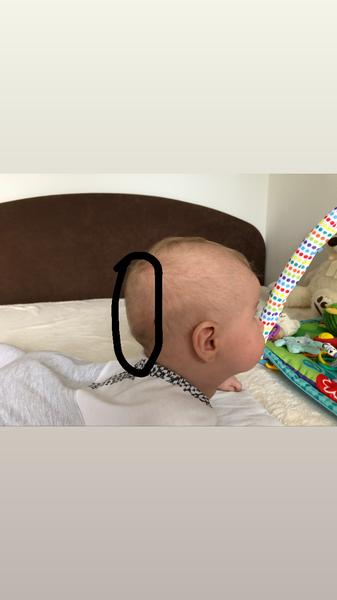 Má môj synček zležanú hlavičku?