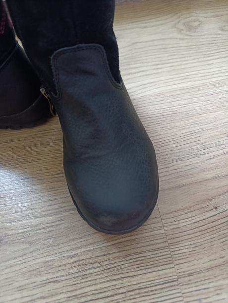 Dievcenske cizmy protetika, protetika,27