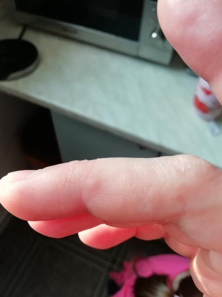 Čo sú tieto vyrážky a ako ich mám liečiť?