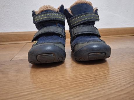 Čižmy protetika, protetika,21