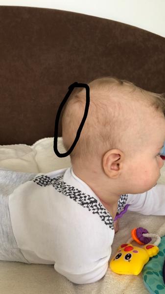 Má môj synček zležanú hlavičku?