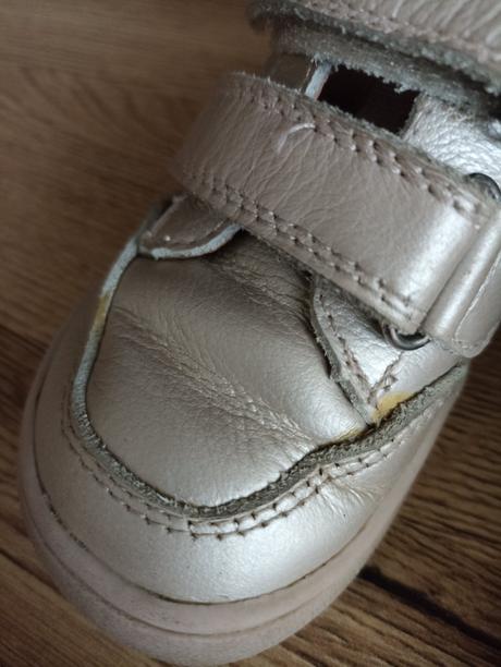 Protetika barefoot jarné topánky, protetika,23