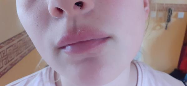 Čo to má dcérka na tvári?