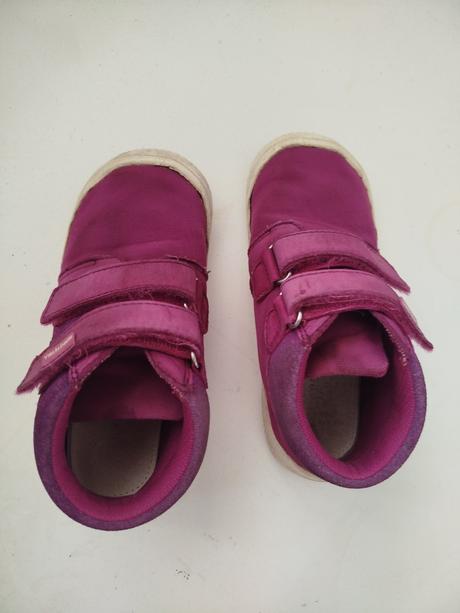 Barefoot tenisky, protetika,28