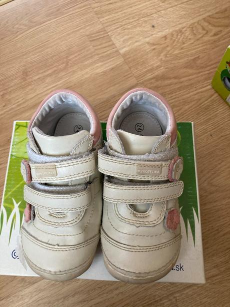 Prechodné topánky, protetika,24